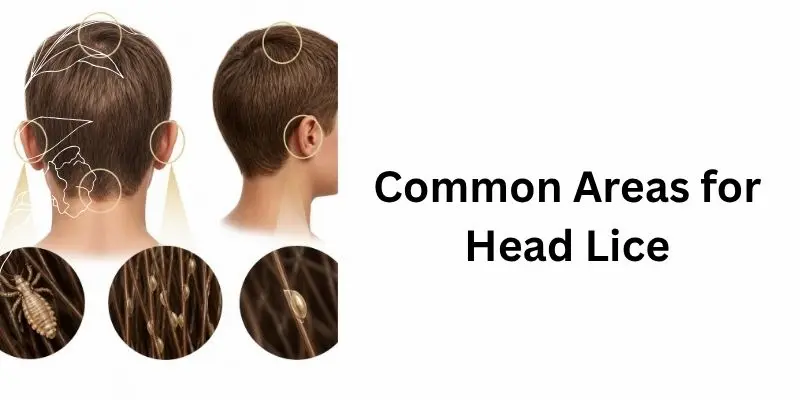 Common Areas Where Head Lice And Nits Are Found