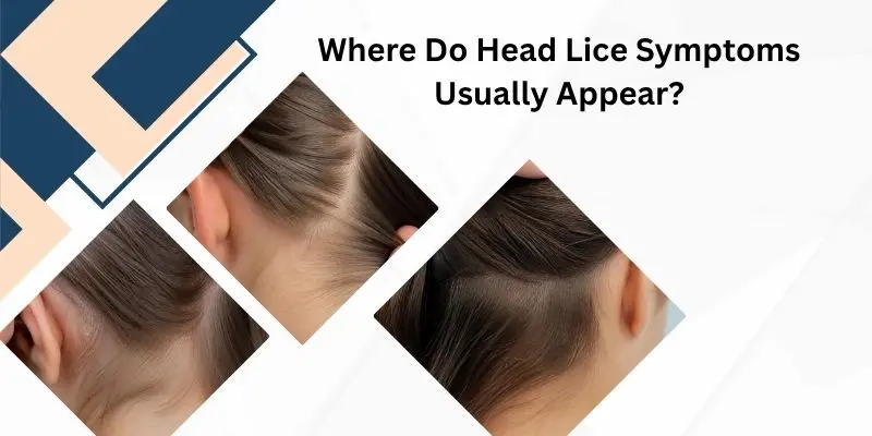 Common Areas Where Head Lice And Nits Are Found
