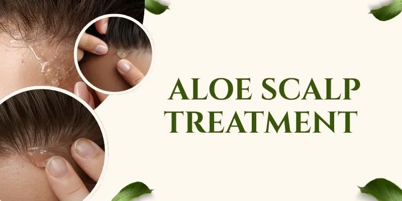 Aloe Scalp Treatment Applying Aloe Vera Scalp Treatment For Mild Flakes