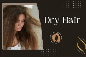 8 Life-Changing Tips to Rescue Dry Hair and Restore Its Natural Beauty - Post Thumbnail