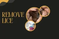 Effective Tips To Remove Lice From Hair Permanently At Home