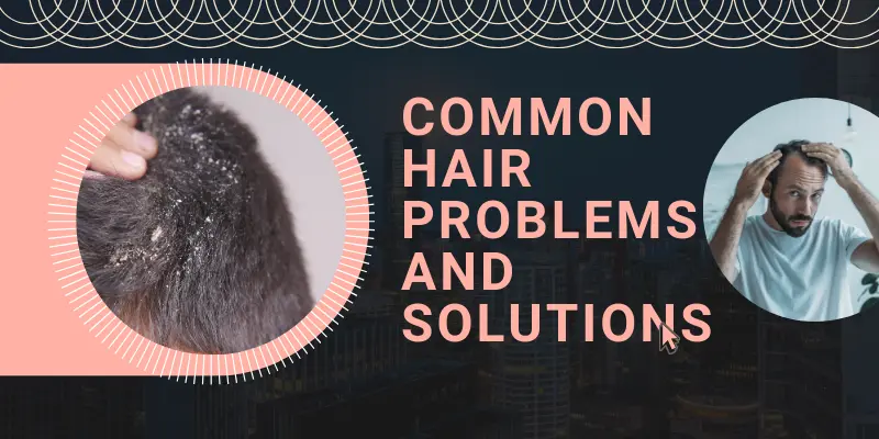 Common Hair Problems And Solutions 2 Common Hair Problems And Solutions – Discover The Best Hair Care Routine For Men To Tackle Dandruff, Dryness, Hair Fall, And Scalp Irritation Effectively.