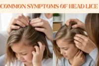 Common Symptoms of Head Lice: 7 Signs to Check