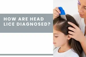 How Are Head Lice Diagnosed? 7 Easy Steps to Check at Home