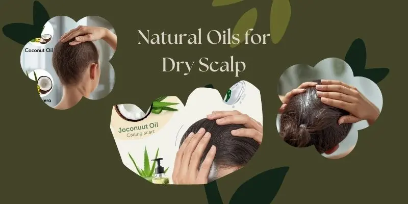 Using Coconut, Jojoba, And Aloe Vera Oils To Treat Dry Scalp