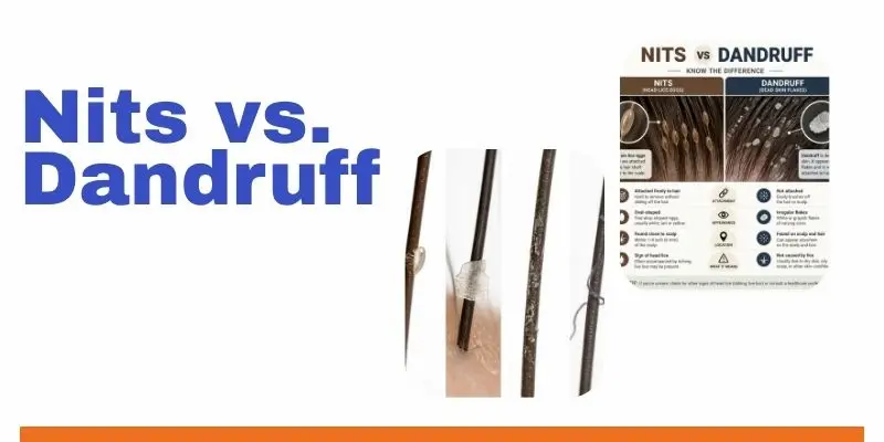 Nits Vs. Dandruff How Can You Tell The Difference Comparison Of A Nit, Dandruff, Hair-Product Residue, And Lint In Hair.