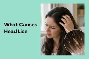 What Causes Head Lice? Causes, Myths & Safe Prevention Tips