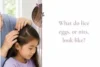 What Do Lice Eggs (Nits) Look Like? 7 Signs to Check - Post Thumbnail