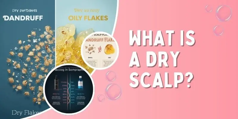 Comparison Of Dry Scalp Flakes And Dandruff Flakes