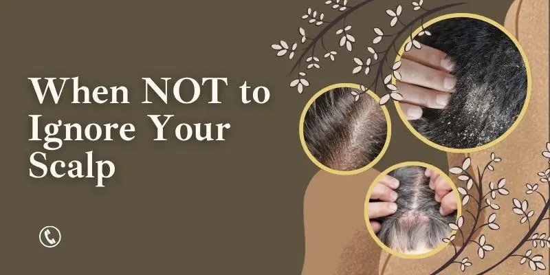 Red And Inflamed Scalp With Warning Signs Of Infection