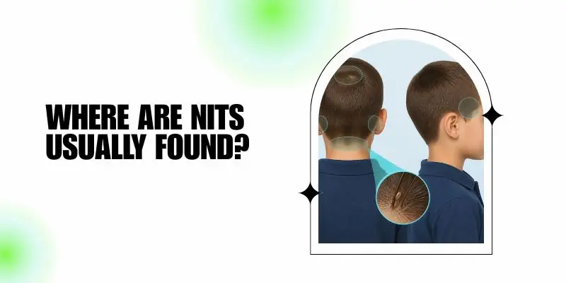 Where Are Nits Usually Found Common Places To Find Nits Behind The Ears And Near The Neckline.