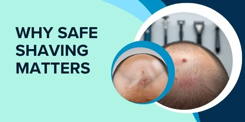 Scalp Showing Minor Irritation From Shaving, Highlighting The Importance Of Safe Shaving.