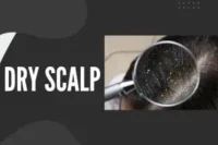 12 Science-Backed Ways To Treat Your Dry Scalp at Home
