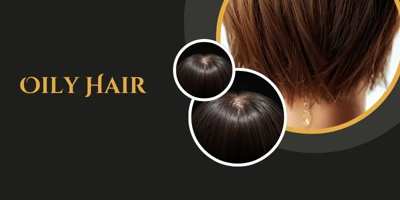 Close-Up Of Oily Hair At The Scalp